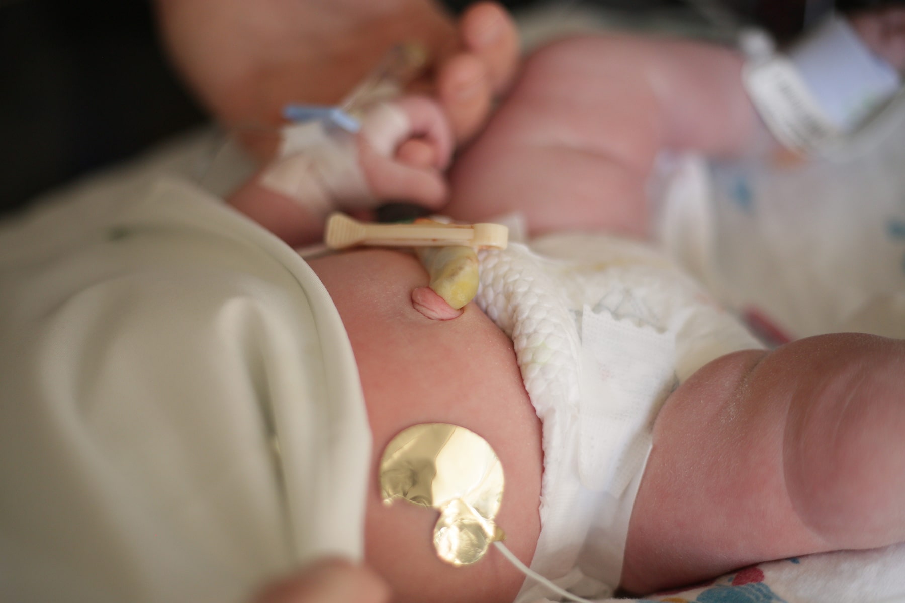 nicu-newborn-baby-B33CDQM-min